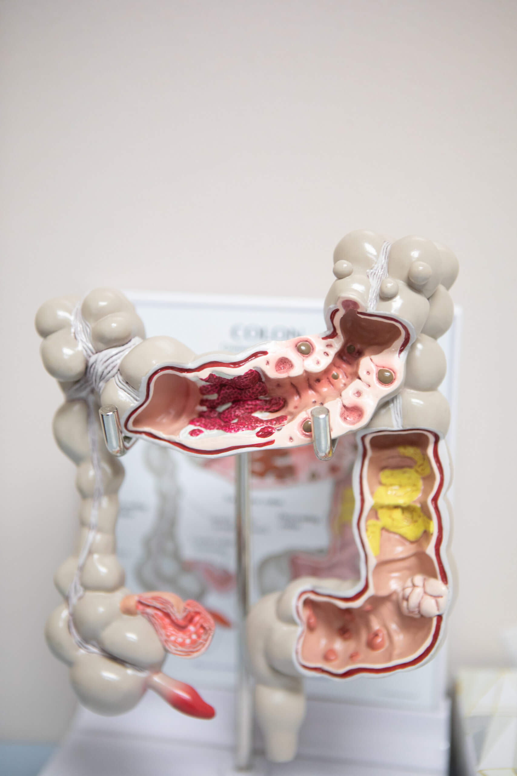 A plastic model of the digestive system used by gastroenterology specialists to show patients